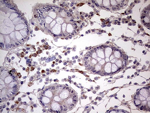 Monoclonal Mouse anti-Human IKZF3 / AIOLOS Antibody (clone OTI5E2, Carrier-free, aa1-301, IHC, WB)