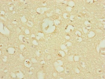 Polyclonal Rabbit anti-Human DNAJC19 Antibody (IHC, WB)