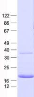 Human TTR / Transthyretin Protein (Recombinant His, N-Terminal)