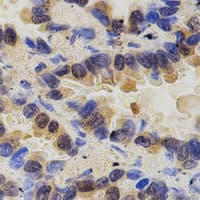 PAK2 Antibody (Internal)