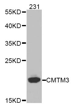 Polyclonal Rabbit anti-Human CMTM3 Antibody (IHC, WB)