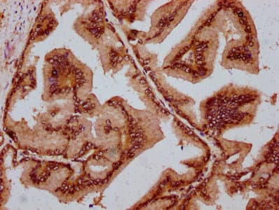 Polyclonal Rabbit anti-Human MAML2 Antibody (IHC, WB)