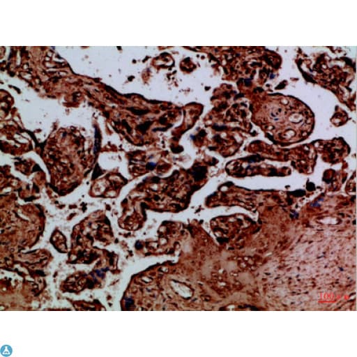 BIRC1 / NAIP Antibody