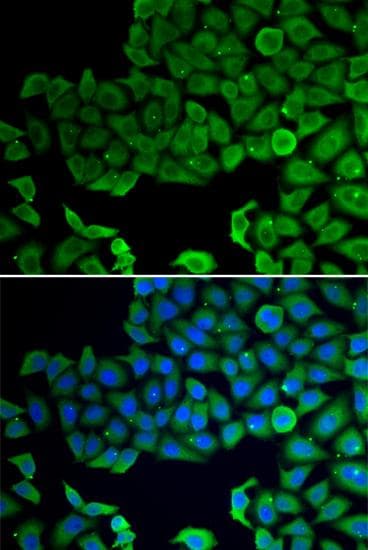 Polyclonal Rabbit anti-Human VPS4A Antibody (IF)