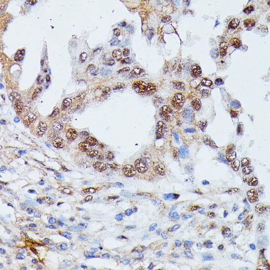 Polyclonal Rabbit anti-Human IGHMBP2 Antibody (IHC)