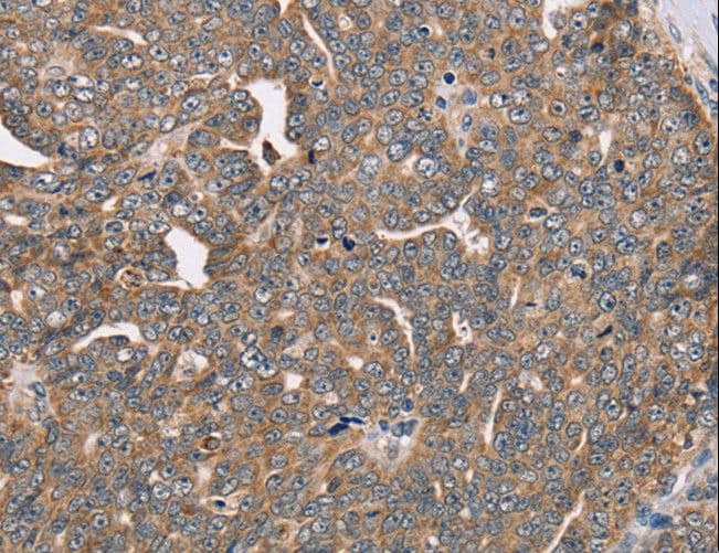Polyclonal Rabbit anti-Human FAIM2 / LIFEGUARD Antibody (IHC)