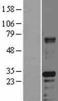 Human HABP2 Protein (Over-Expression Lysate Myc-DDK (Flag))