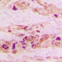 Polyclonal Rabbit anti-Human ANXA3 / Annexin A3 Antibody (Internal, IHC, WB)