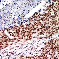 WDR11 / PHIP Antibody