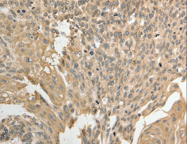 GSR / Glutathione Reductase Antibody