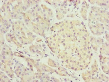 TRIM1 / MID2 Antibody