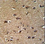 GCAT Antibody (aa155-181)