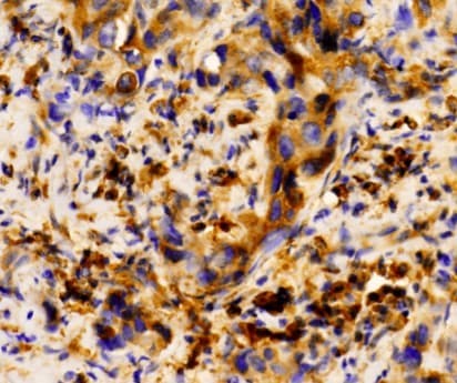 Polyclonal Rabbit anti-Human S100A8 / MRP8 Antibody (IHC, WB)