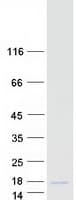 Human CALCB Protein (Recombinant Myc-DDK (Flag))