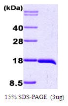 Human IL-1B / IL-1 Beta Protein (Recombinant)