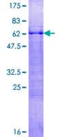 Human BARHL1 Protein (Recombinant GST)