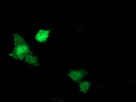 Monoclonal Mouse anti-Human STAT5A Antibody (clone OTI8H1, IF, WB)
