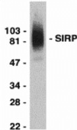 IHC-plus™ Polyclonal Rabbit anti-Human SIRPA / CD172a Antibody (IHC, WB)
