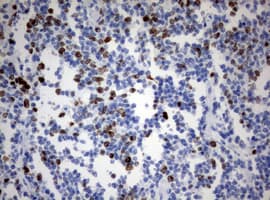 MKI67 / Ki67 Antibody (aa1160-1493, clone OTI5D5)
