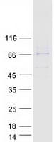 Human HDC / Histidine Decarboxylase Protein (Recombinant Myc-DDK (Flag))