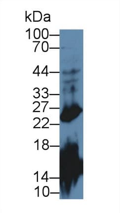 GH / Growth Hormone Antibody (aa28-216)