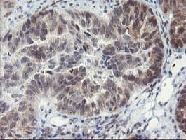 TASP / LANCL2 Antibody (clone OTI2A11)