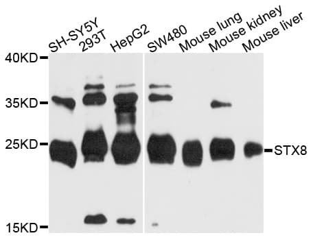 Polyclonal Rabbit anti-Human STX8 / Syntaxin 8 Antibody (WB)