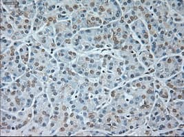 Monoclonal Mouse anti-Human GAD1 / GAD67 Antibody (clone OTI3G9, IHC, WB)