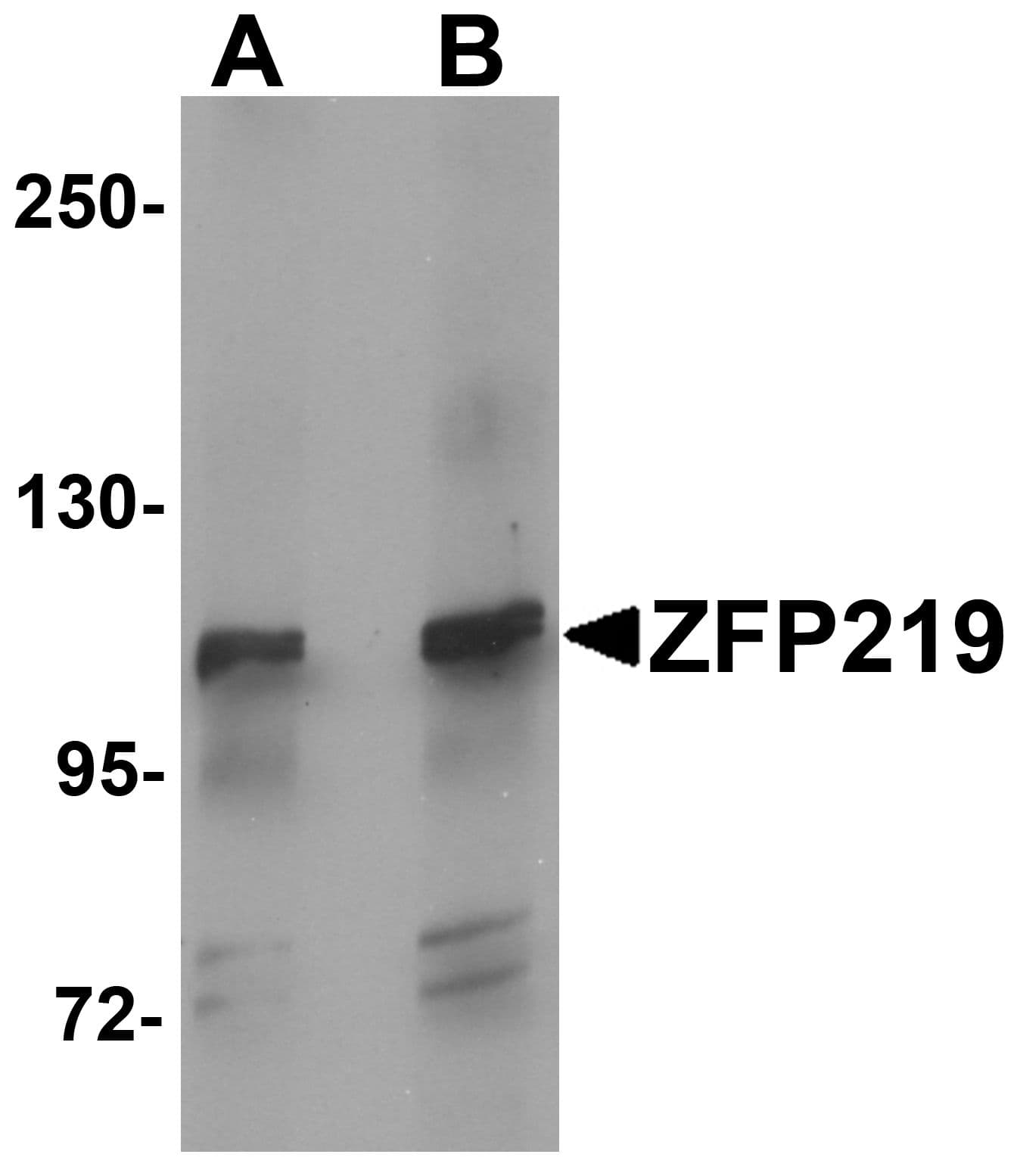 ZFP219 / ZNF219 Antibody
