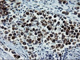 ERBB2 / HER2 Antibody (aa676-1255, clone OTI1A12, Carrier-free)