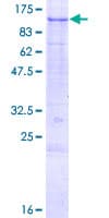 Human SENP5 Protein (Recombinant GST)