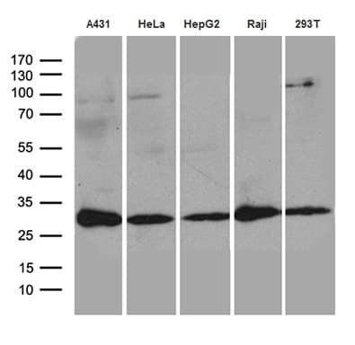 RANBP1 Antibody (clone OTI8E1)