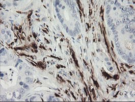 F13A1 / Factor XIIIa Antibody (clone 1H2, Carrier-free)