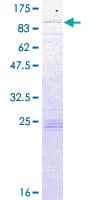 Human SLC27A1 / FATP Protein (Recombinant GST)