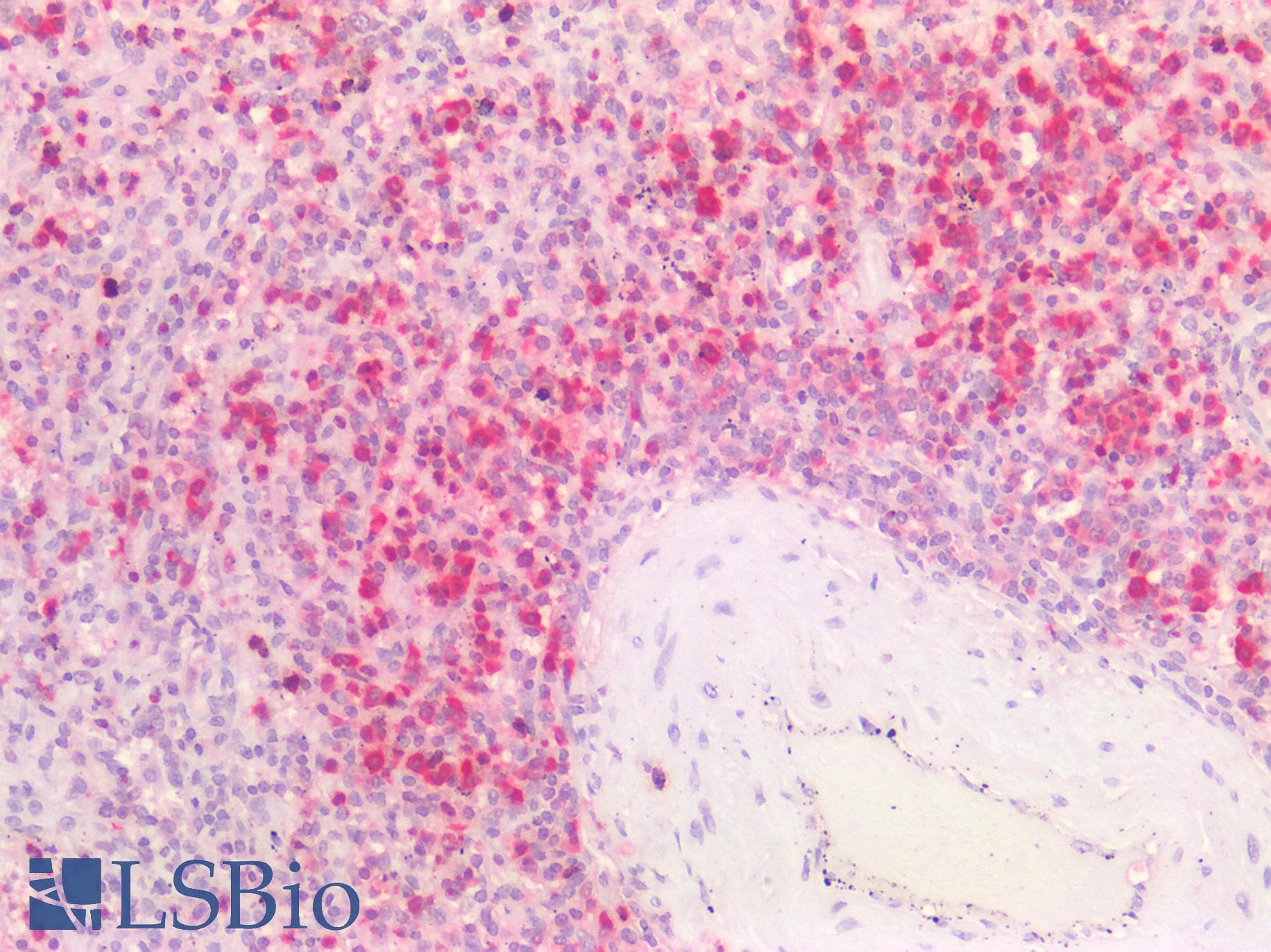 PathPlus™ HNE / Neutrophil Elastase Antibody