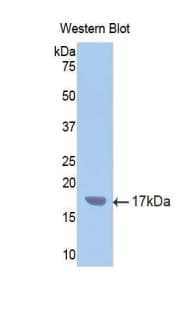 CYP2E1 Antibody (aa378-493)