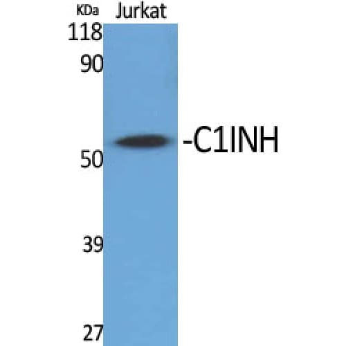 Polyclonal Rabbit anti-Human SERPING1 / C1 Inhibitor Antibody (320-400 aa, Internal, IHC, WB)