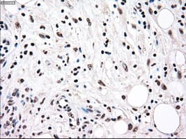 RAD9A / RAD9 Antibody (clone OTI7B11)