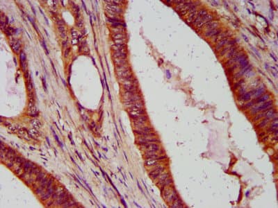 Polyclonal Rabbit anti-Human MAD2L1 / MAD2 Antibody (aa2-205)
