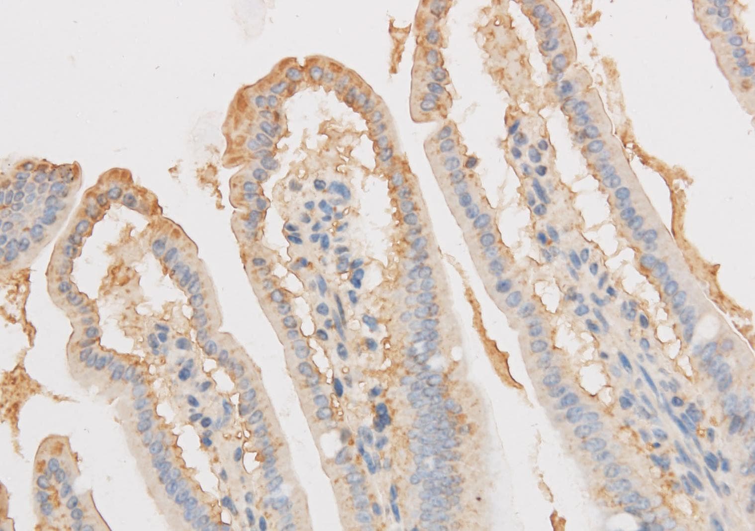 VDAC1 / PORIN Antibody