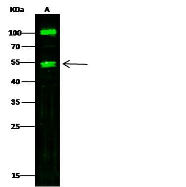 Polyclonal Rabbit anti-Human CPA1 / Carboxypeptidase A Antibody (Preservative Free, IHC, WB)
