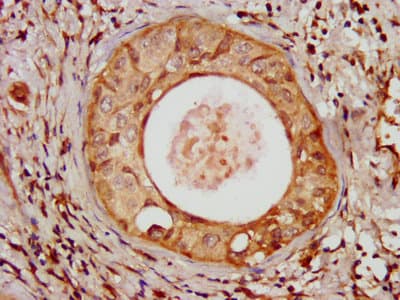 UMPS / OPRT Antibody