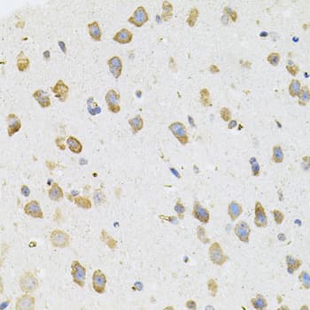TGM2 / Transglutaminase 2 Antibody