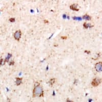 Polyclonal Rabbit anti-Human CHMP1B Antibody (IHC, WB)