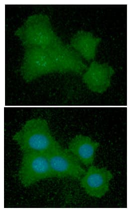 Monoclonal Mouse anti-Human EIF5A Antibody (clone AT4D1, WB)