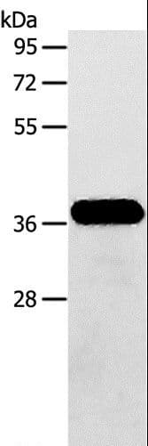 Polyclonal Rabbit anti-Human AASDHPPT / LYS5 Antibody (IHC, WB)