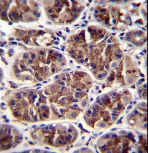 Polyclonal Rabbit anti-Human GDF5 / GDF-5 Antibody (aa343-371, IHC, WB)