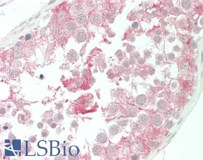 IHC-plus™ RALDH2 / ALDH1A2 Antibody (aa394-443)