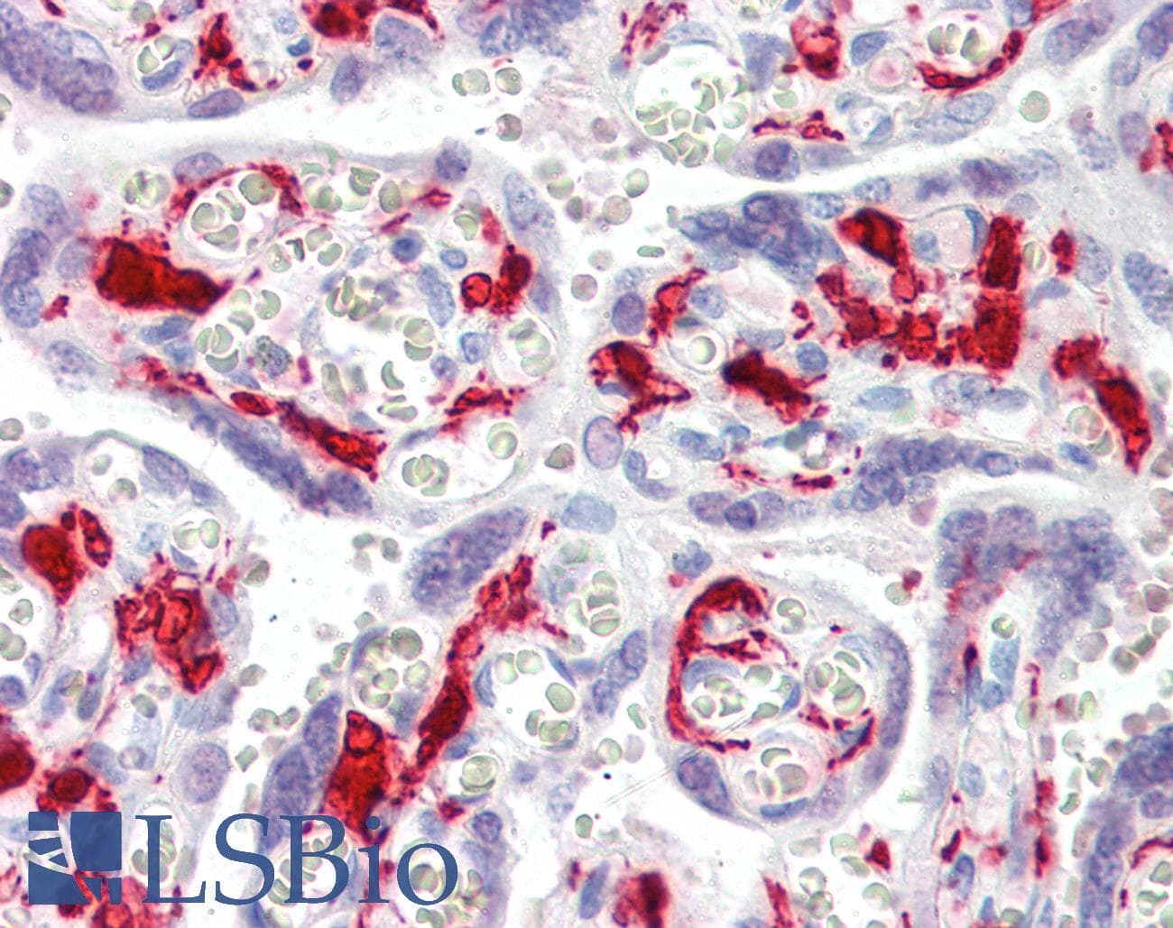 IHC-plus™ F13A1 / Factor XIIIa Antibody