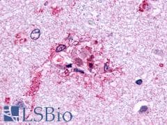 PathPlus™ GLP2R Antibody (N-Terminus)
